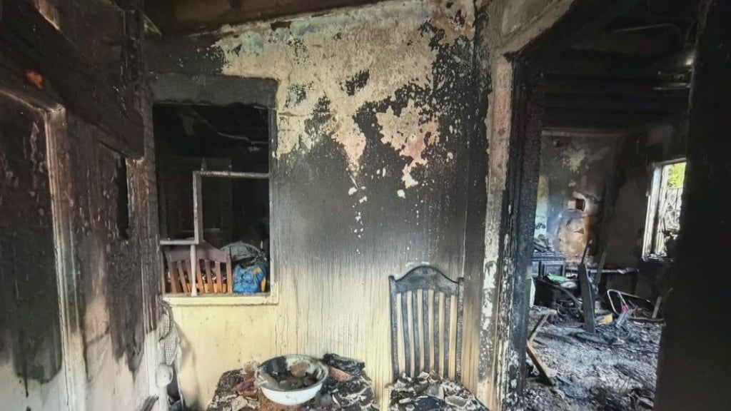 Woman hospitalized after Miami house fire leaves three displaced — CBS Miami, Aventura Health news