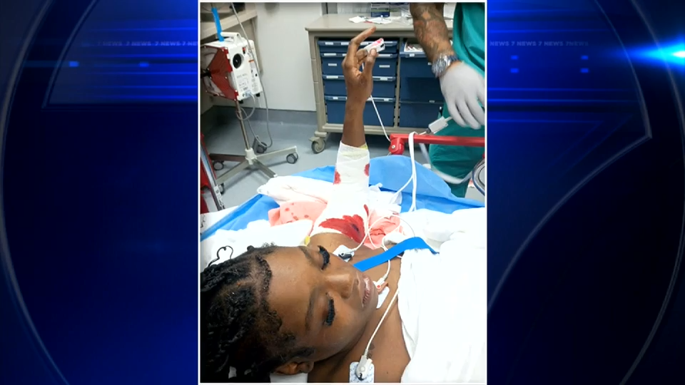 17-year-old speaks out while recovering from serious injuries in pit bull attack in NW Miami-Dade — WSVN 7 Miami-Dade, Aventura Health news